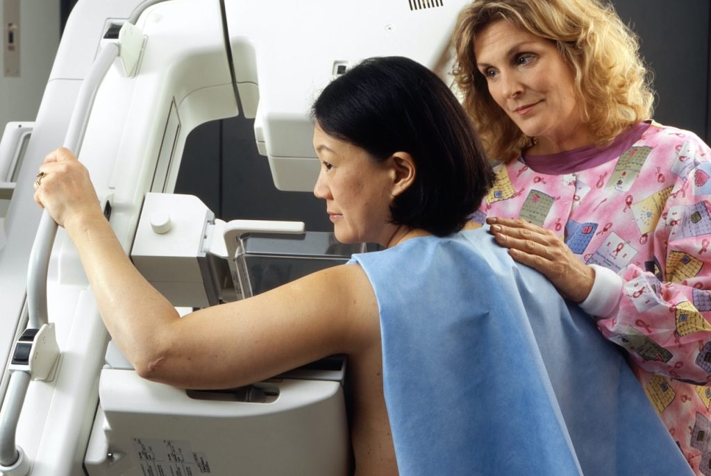 乳房X光攝影檢查